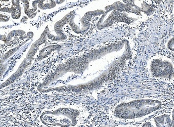 PPM1A Antibody