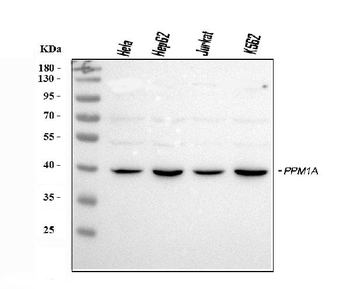 Anti-PPM1A Antibody