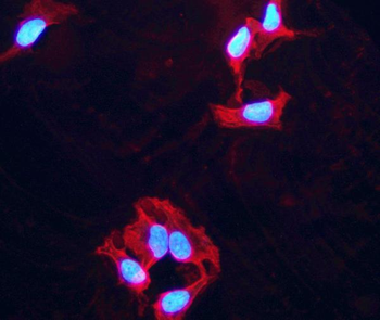 Anti-PPM1D/WIP1 Antibody