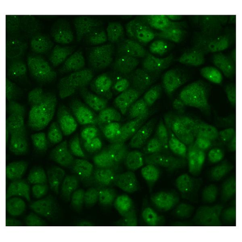 Anti-PPM1E Antibody