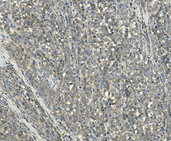 Anti-PPM1E Antibody