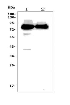 Anti-PPM1E Antibody