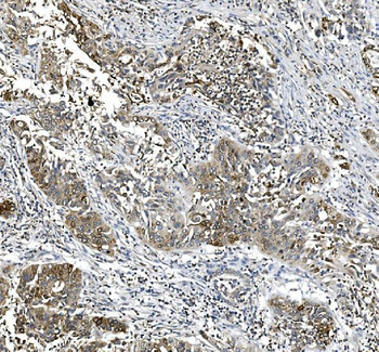 Anti-COX2/Cyclooxygenase 2/PTGS2 Antibody