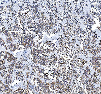 Anti-COX2/Cyclooxygenase 2/PTGS2 Antibody