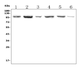 PTPN22 Antibody