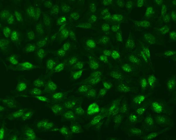 Anti-RNF168 Antibody