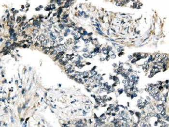 Anti-RNF168 Antibody