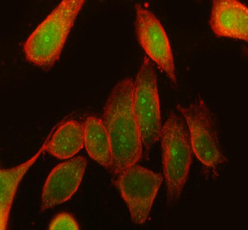 Anti-Rsk 2/MAPKAP Kinase 1b/RPS6KA3 Antibody