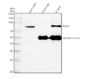 Anti-Rsk 2/MAPKAP Kinase 1b/RPS6KA3 Antibody