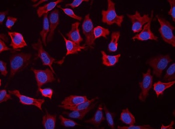Slc25a1 Antibody