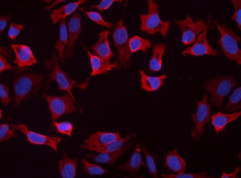 Anti-Slc25a1 Antibody