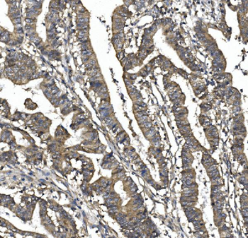 Anti-SORBS1 Antibody