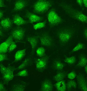 Anti-SUFU Antibody
