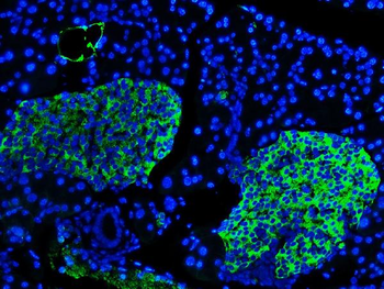 Anti-Synaptophysin/SYP Antibody