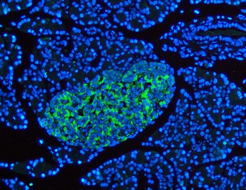 Anti-Synaptophysin/SYP Antibody