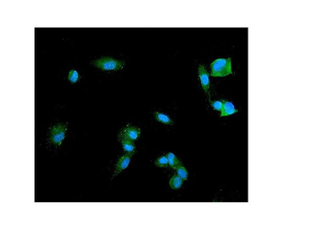 Anti-Synaptophysin/SYP Antibody
