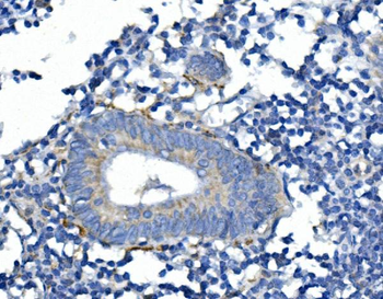 Anti-Synaptophysin/SYP Antibody