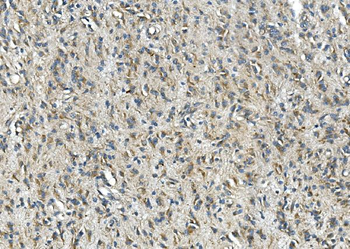 Anti-Synaptophysin/SYP Antibody