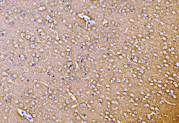 Anti-Synaptophysin/SYP Antibody