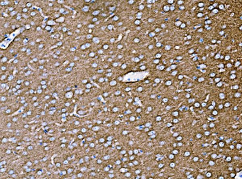 Anti-Synaptophysin/SYP Antibody