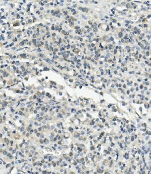 Anti-UBE3A Antibody