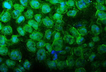 Anti-UBR2 Antibody