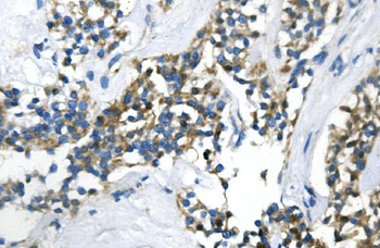 Anti-UBR2 Antibody