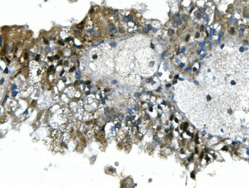 Anti-UBR2 Antibody