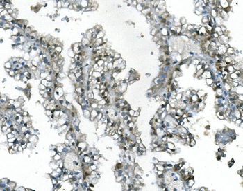 Anti-UBR2 Antibody