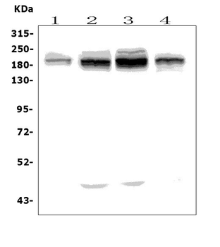 Anti-UBR2 Antibody