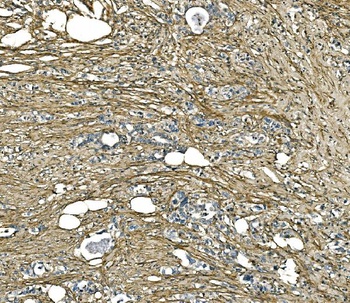 Collagen I/COL1A1 Antibody