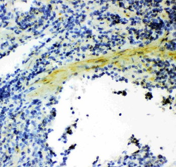 Anti-Gelsolin/GSN Antibody