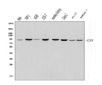 Gelsolin/GSN Antibody