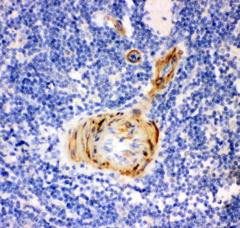Anti-Gelsolin/GSN Antibody