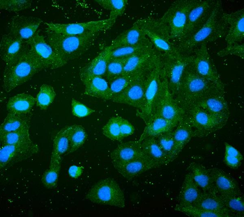 Anti-RP2 Antibody (monoclonal, 3D7)