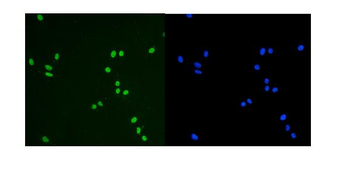 Anti-KAP1/TRIM28 Antibody (monoclonal, 3H2)