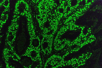 Anti-KAP1/TRIM28 Antibody (monoclonal, 3H2)