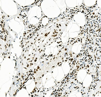 Anti-KAP1/TRIM28 Antibody (monoclonal, 3H2)