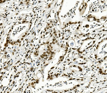 Anti-KAP1/TRIM28 Antibody (monoclonal, 3H2)