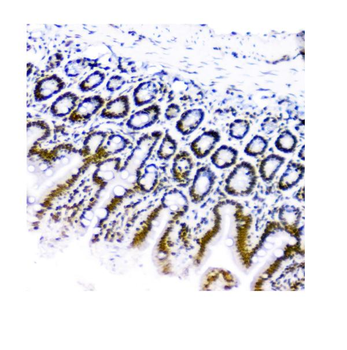 Anti-KAP1/TRIM28 Antibody (monoclonal, 3H2)