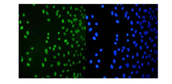 Anti-KAP1/TRIM28 Antibody (monoclonal, 9E3)