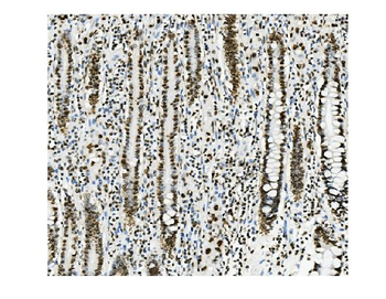 Anti-KAP1/TRIM28 Antibody (monoclonal, 9E3)