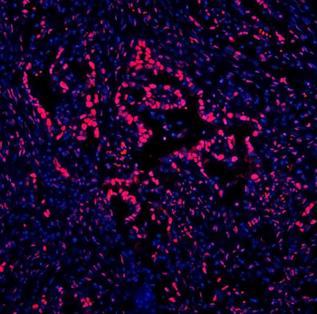 Anti-DDX5 Antibody (monoclonal, 3F9)