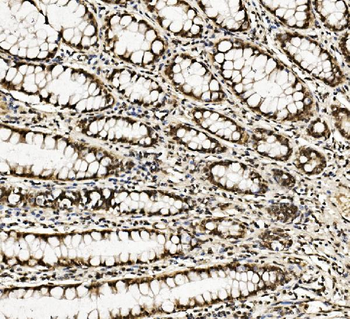 Anti-DDX5 Antibody (monoclonal, 3F9)