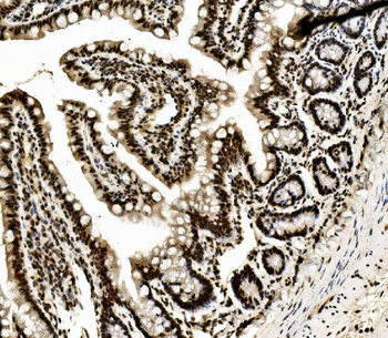 Anti-DDX5 Antibody (monoclonal, 3F9)