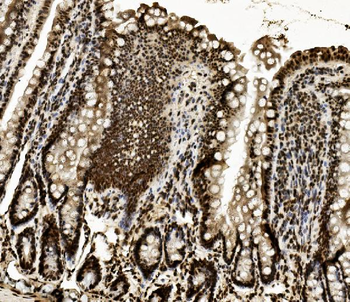 Anti-DDX5 Antibody (monoclonal, 3F9)