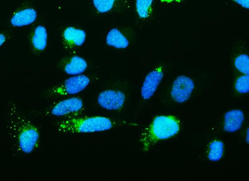 Anti-Ribonuclease Inhibitor/RNH1 Antibody (monoclonal, 4F3)