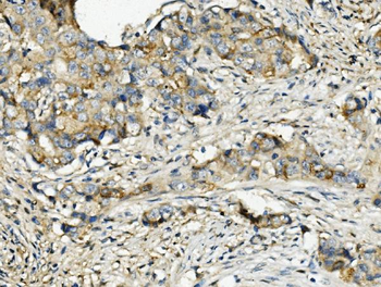Anti-Ribonuclease Inhibitor/RNH1 Antibody (monoclonal, 4F3)