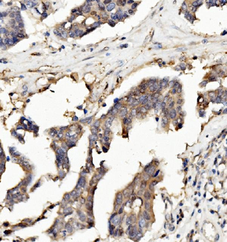 Anti-Ribonuclease Inhibitor/RNH1 Antibody (monoclonal, 4F3)