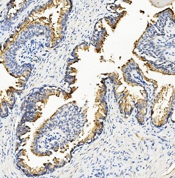 Anti-Ribonuclease Inhibitor/RNH1 Antibody (monoclonal, 4F3)
